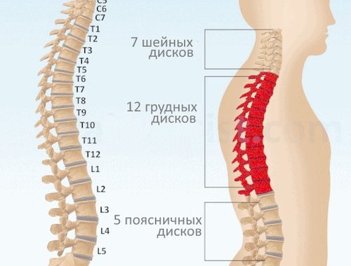 грыжа диска грудного отдела