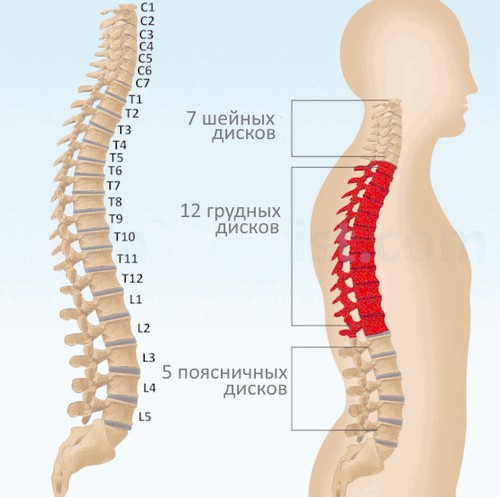 грыжа диска грудного отдела